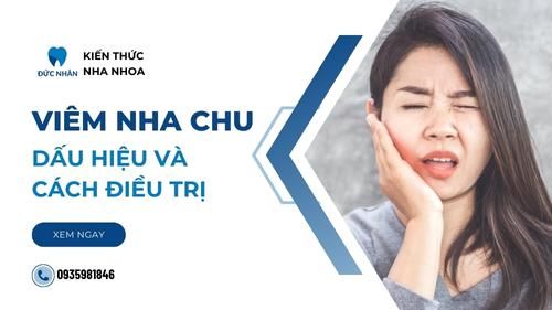 Viêm nha chu là gì? Dấu hiệu nhận biết và cách điều trị nha chu